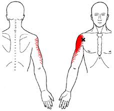 Bicipital Tendinitis Referred Pain Pattern