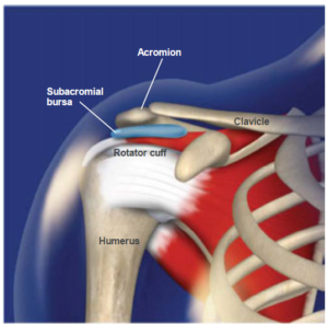 shoulder-impingement-syndrome